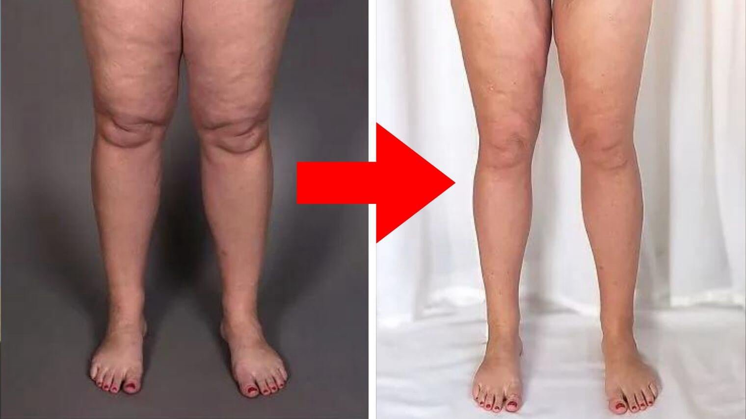 Nooro Whole Body Massager 7